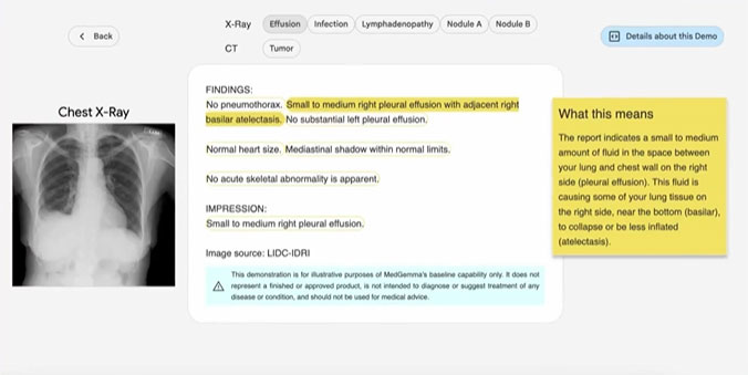 Google MedGemma
